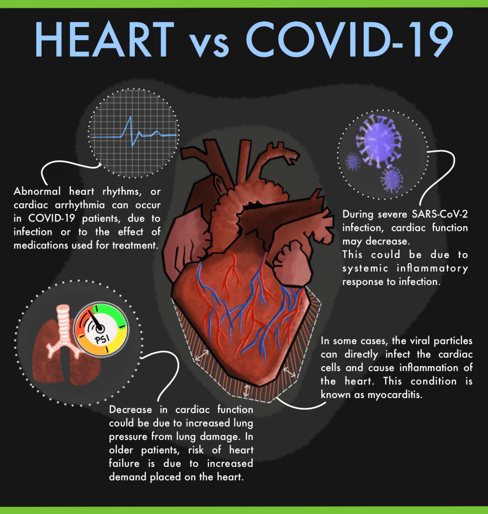 covid-19 myocarditis